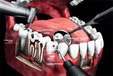 Dental Center dentamaks kívül Dubninskaya Beskudnikovsky District