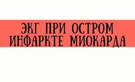 Морфология на инфаркт на миокарда 1