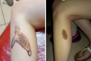 Pot obține un tatuaj pe un semn din naștere sau aluniță - 28 fotografii, Yurets inima de stejar