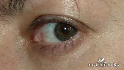 Nincs találat a bőrt és a szemet - Biocon krém eszköz a szem körüli bőr 40