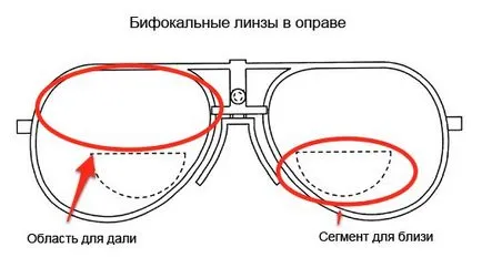 Едновременното присъствие на късогледство и далекогледство, за очно заболяване