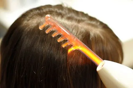 Foltos kopaszodás okai és a hajhullás kezelésére