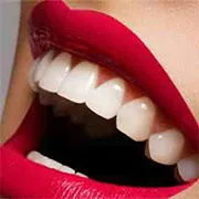 Избелване на зъби увеличение в стоматологията ilatan