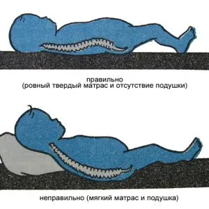 Ортопедични матраци видове, как да се избират ортопедичен матрак