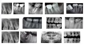 În centru - Apollonia Dental Center