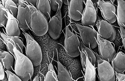 Паразити, Giardia в черния дроб на човека симптоми и лечение при възрастни