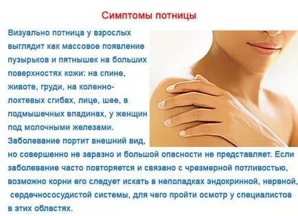 Sudamen възрастни - снимки, симптоми и лечение на проявите на бодлив топлина