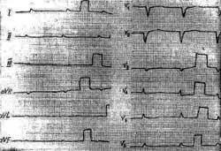 boli de inima rare și dificultatea diagnosticului lor