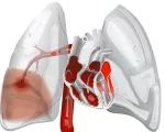 Sindromul de Morgagni-Adams-Stokes - cauze, simptome, diagnostic și tratament