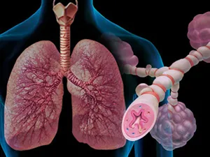 Szindrómák asthma bronchiale