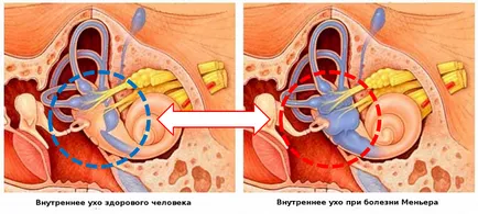 Шум в ушите и световъртеж, причини, лечение, симптоми