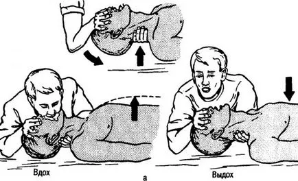 Sindromul de Morgagni-Adams-Stokes - cauze, simptome, diagnostic și tratament