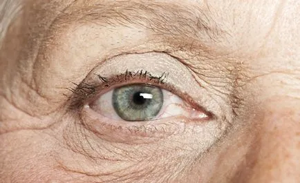 öregedő szemek