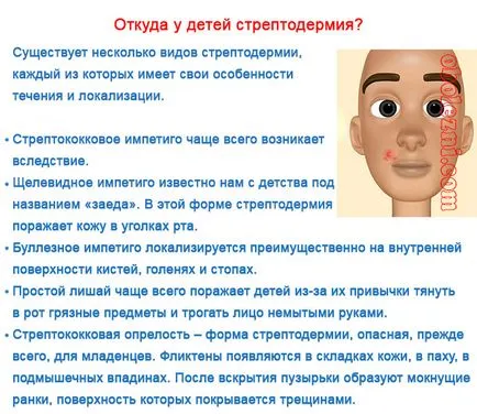 Streptoderma деца - снимка с подробно описание на симптомите