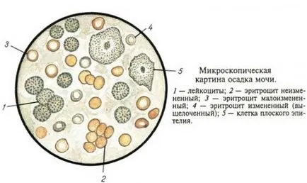 Свещи diklovit простатит какви са плюсовете и минусите на лекарството