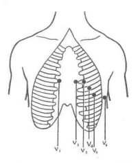 technika EKG