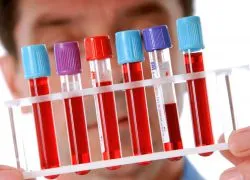 Thrombocytosis - Okok és kezelés