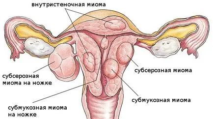 Trage abdomenul inferior după cauze menstruale