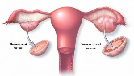 Húz az alhasi menstruáció után okok