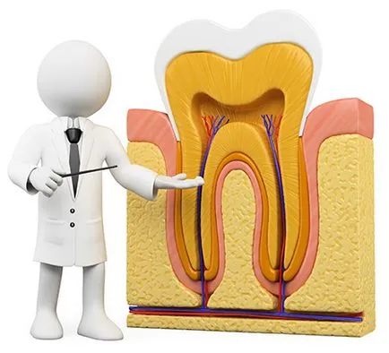 Премахване на зъб нерв - цената, когато искате да изтриете, зъбобол след отстраняване на нерв - защо,