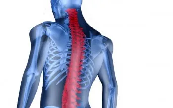 osteoartrita Unkovertebralny a coloanei cervicale cauze, simptome, diagnostic, tratament