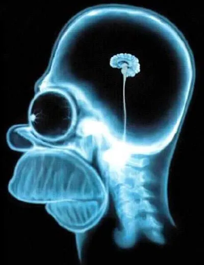 Mind a fogorvosok kell egy x-ray