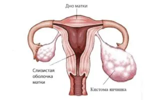 Заболяванията по време на менопаузата при болестта на жените и възпаление на гениталиите