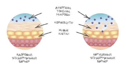 Védőfal a bőr epidermális barrier tulajdonságokat