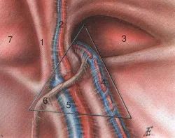 Ultrasunete a canalului inghinal, portalul radiologi