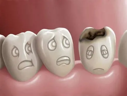 5 moduri naturale de a scăpa de cariilor fără dentist