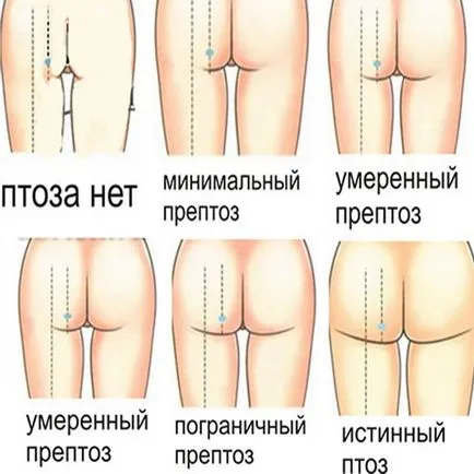 Анатомия на седалищните мускули, как да се затегне задните части и да направи еластична задник