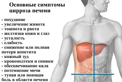 Предизвиква чернодробна цироза, симптоми, лечение