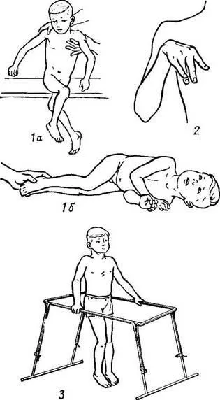 Церебрална парализа лечение заболяване Little