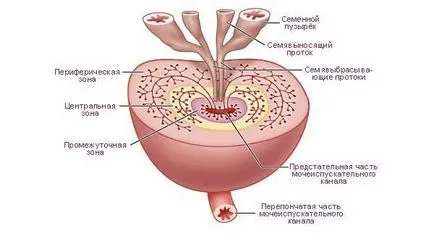 simptome fibroza prostatei, tratament, prognostic