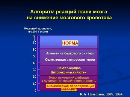 Исхемичен инсулт изпълнени член