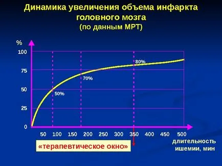 Исхемичен инсулт изпълнени член