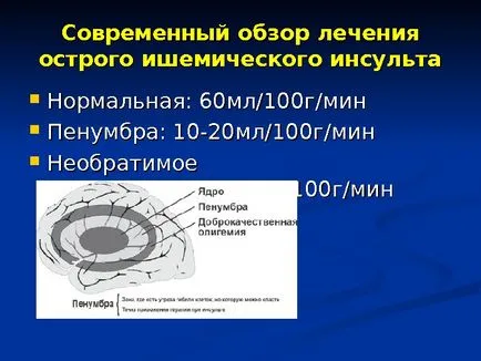 Исхемичен инсулт изпълнени член