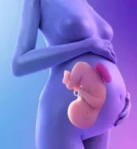 moarte fetală intrauterină