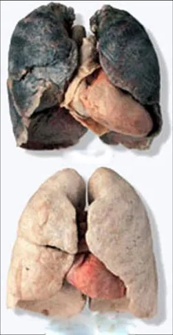 Ефектът на пушенето на дихателната система