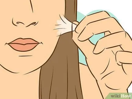 Как да причини обезцветяване на белези от акне