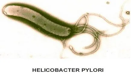 Лечение на Helicobacter Pylori режим
