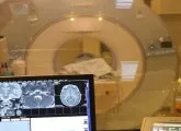 MRI a kórházban Semashko Lublin SEAD
