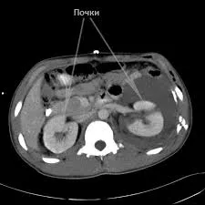 MRI на бъбреците и пикочния мехур обучение