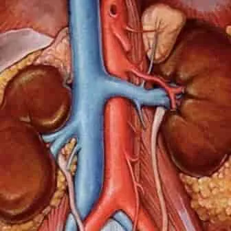 Nephrosclerosis - tünetek és kezelés