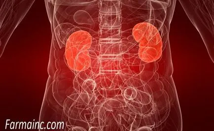 Nephritis (glomerulonephritis, pyelonephritis)