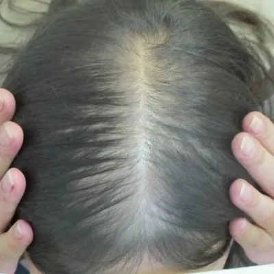 Clinic, klinika Intézet - szép haj