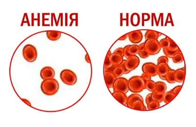 Паразитни чернодробна киста симптоми, лечение и причини