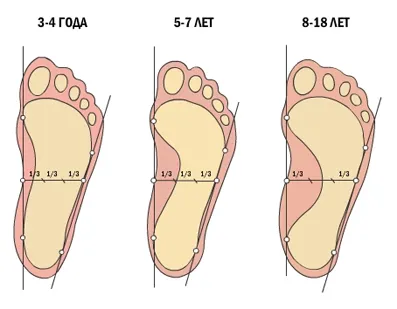 Lapos és valgus deformitás i ujj