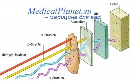 Indicații pentru radioterapie