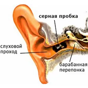 Halláskárosodás (süketség) az egyik fül okok és a kezelés
